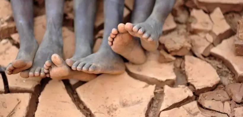 皮肤干燥口干舌燥缺什么维生素,干燥症口干吃什么药效果好