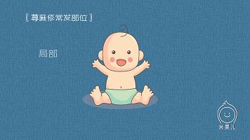 讲一下湿疹如何治疗,教你一分钟区分湿疹皮肤病