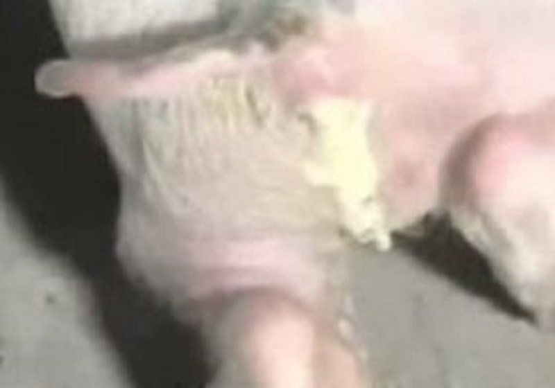 仔猪白痢最佳治疗方法,仔猪白痢治疗法