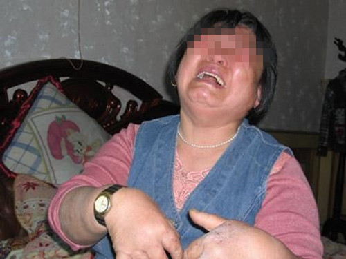 家长给女儿洗澡发现腹部鼓起来,妈妈给小孩洗澡发现问题