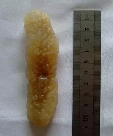 你知道世界上的鱼类有多少个,你知道的海底世界有多少种鱼