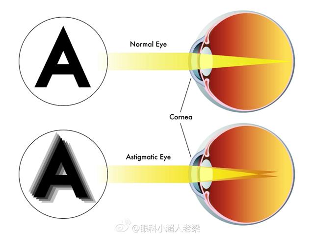 弱视专家王大夫,王大夫小儿微针疗法视频