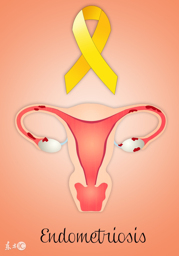 女性没有子宫的原因