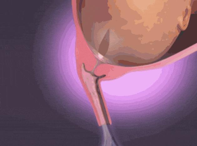 生孩子产程过长,生孩子顺产全产程最快要多久