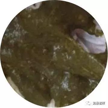 宝宝拉绿便最常见的10种原因,宝宝绿便11种改善方式