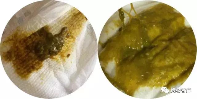 宝宝拉绿便最常见的10种原因,宝宝绿便11种改善方式