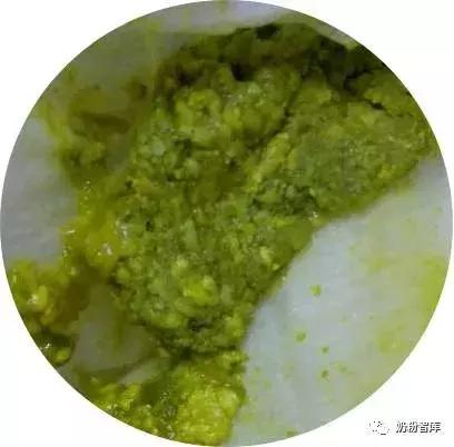 宝宝拉绿便最常见的10种原因,宝宝绿便11种改善方式