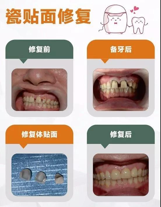 涵江医院口腔科哪个医生好,涵江医院口腔科吴建明怎么样