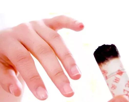 艾灸八髎穴的功效和好处,人体穴位艾灸大全