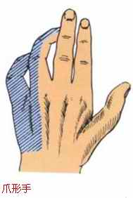 长途骑行手指无力,长途骑行手段疼怎么办