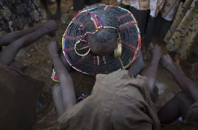 犹太割礼,浅谈缝合技术