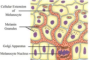 激光祛斑能祛遗传斑吗,祛斑祛黑色素最有效的方法