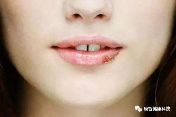 妇科上火什么方法有效降火,女性易上火咋调理