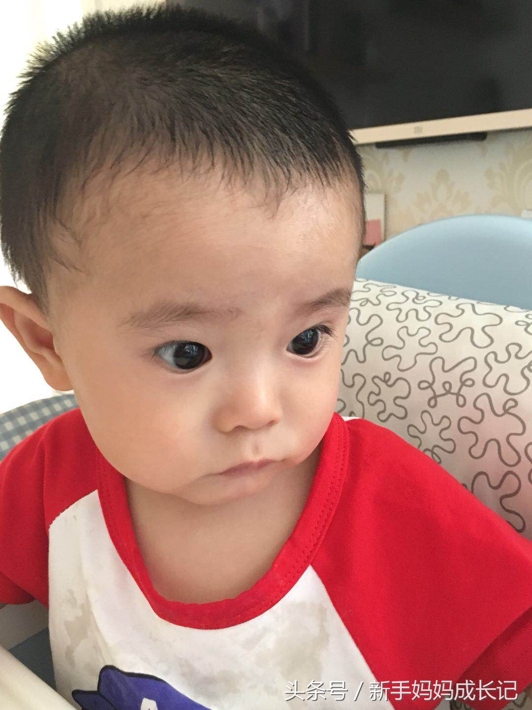 婴儿湿疹的分类及症状,湿疹多久变成慢性湿疹症状