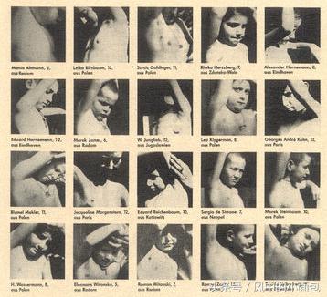 一半是科学，一半是冷血，历史上那些臭名昭著的科学实验