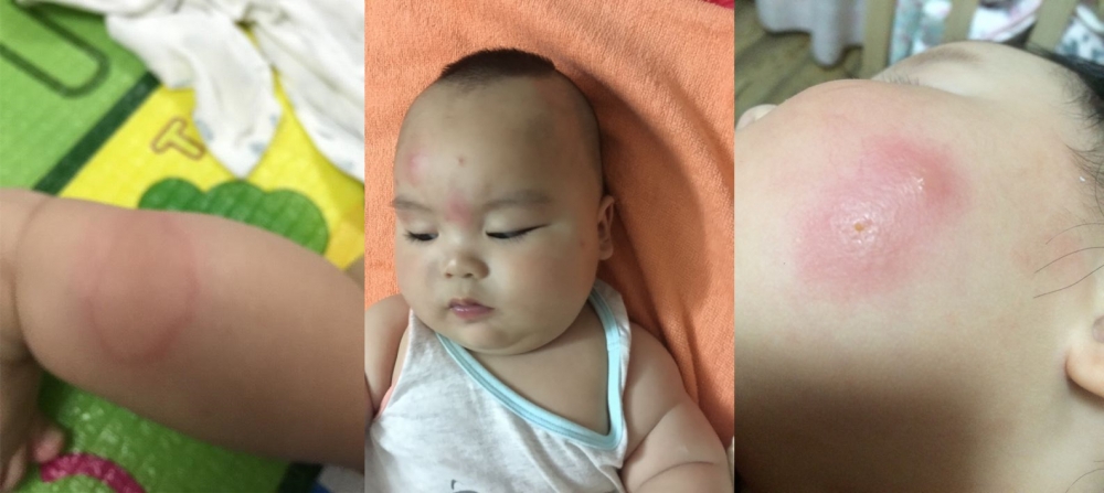 蚊子君全部视频,怎么有效驱蚊野外防蚊子叮咬