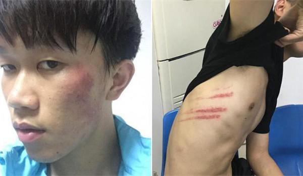 法律专家：武汉宏兴的球场*力暴**已构成4项犯罪事实，可以量刑！