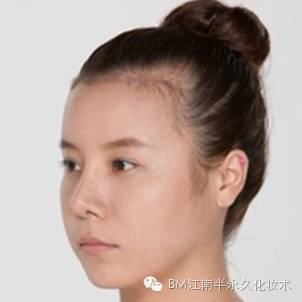 发际线很秃的女星,调整过发际线的明星