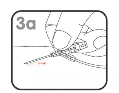 输液扎针最全最新示范,扎针输液的示范