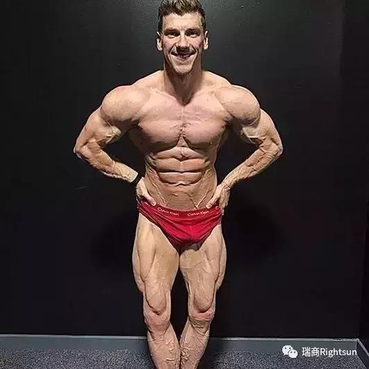 健美冠军体脂率是多少,26岁健美冠军小腿静脉爆裂