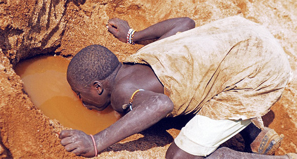 实拍：那些饱受摧残的非洲儿童，穷得让人无法想象！