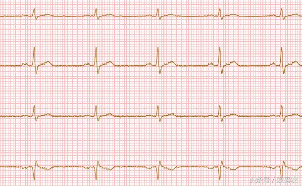 16个富有创意的HTML5Canvas动画特效集合