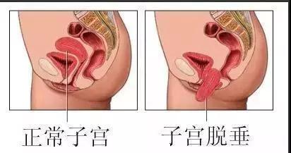 绝经后，子宫也会给你发出“警报”