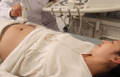 胎儿b超拍照,孕期b超留念