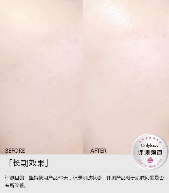 欧珀莱焦点净白淡斑精华露测评,aupres焦点净白淡斑精华露