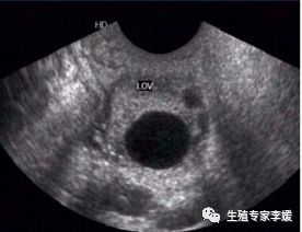 刚生育的女性要注意什么,有生育要求的女性