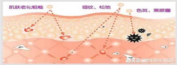 微整形要注意些什么,微整形要注意什么
