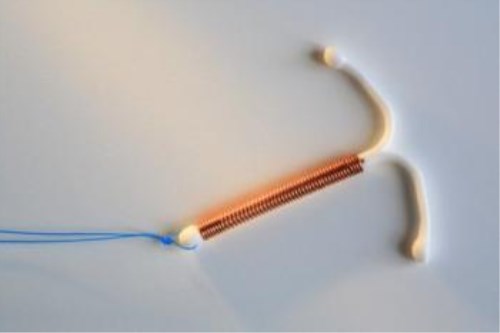 取环有什么讲求吗,取环容易出现什么意外