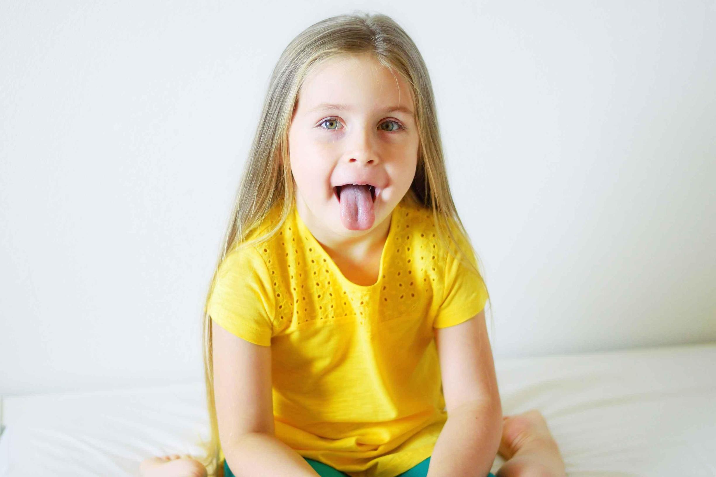 舌苔发黑辨证,舌苔整体发黄警惕四种原因