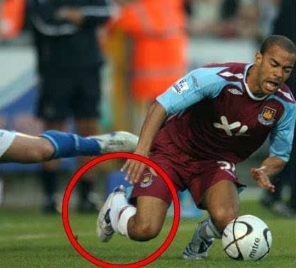 足球史上10大最严重的断腿视频,挥不去的梦魇结局