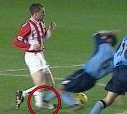 足球史上10大最严重的断腿视频,挥不去的梦魇结局