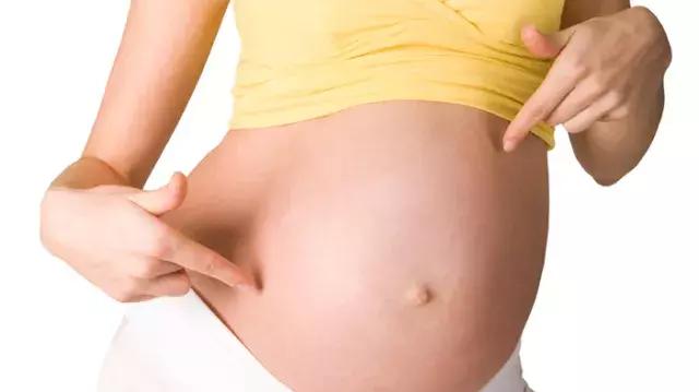 盘点常见的四种分娩方式,分娩的错误认知