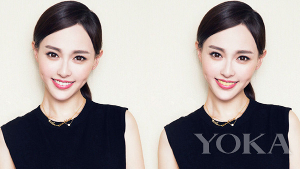 大变脸原来整牙才是高颜值,女星整牙都是越整越美