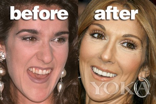 大变脸原来整牙才是高颜值,女星整牙都是越整越美