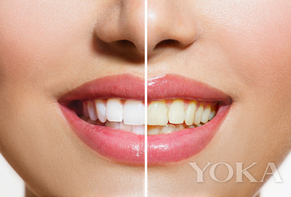 大变脸原来整牙才是高颜值,女星整牙都是越整越美