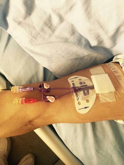 picc药物堵管的原因不包括,双腔picc堵管怎么办