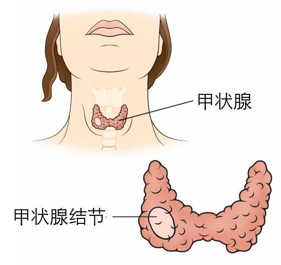 甲府事件有哪些,甲府市在哪里
