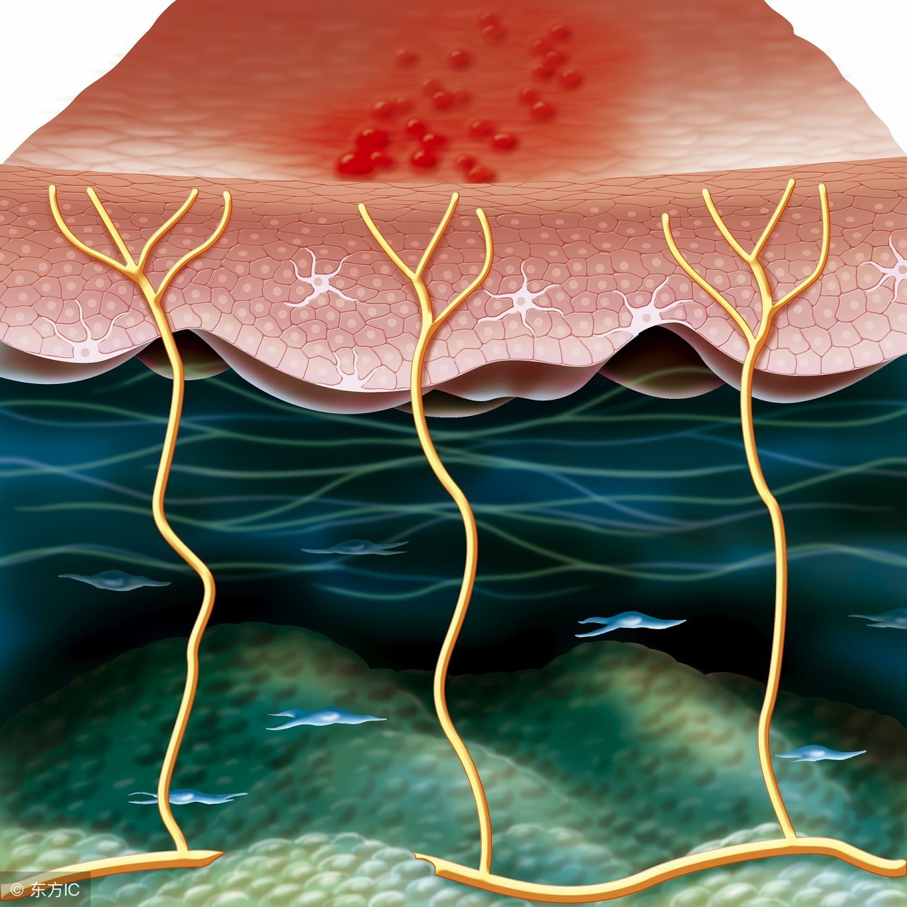 治疗生殖器疱疹25例全部治愈,生殖器疱疹疾病预防和治疗