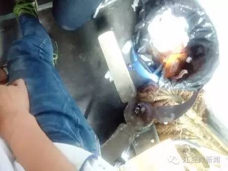 武汉爹爹暴雨中趟水染丹毒|大妈疑似被迫录视频：生吃灯泡、金鱼、仙人球