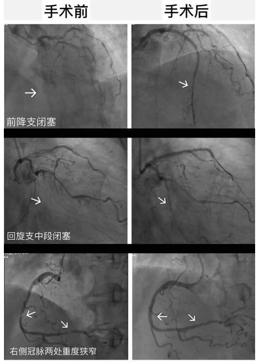 安钢总医院名医系列推送活动之——心血管内科专家李东旺