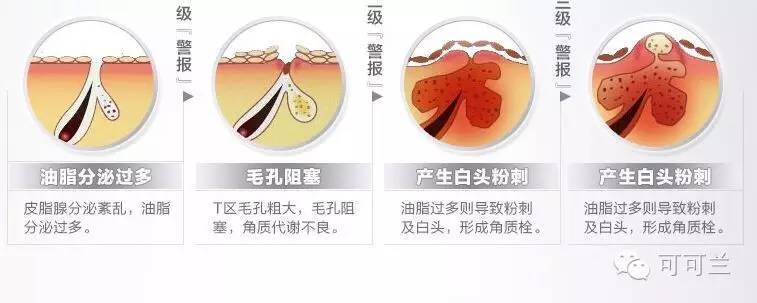 夏天常见皮肤问题,夏天你们都有什么肌肤问题