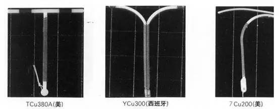 什么样的女性不适合上环,单身女性上环是什么心态