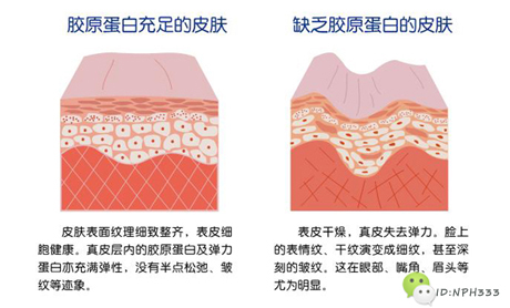 你只知道胶原蛋白能美容养颜？那可不行！