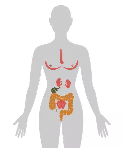 20张癌症人体地图告诉你致癌真相,2020癌症数据报告