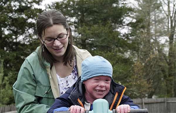 小儿子鱼鳞皮肤,小男孩出生就患皮肤病