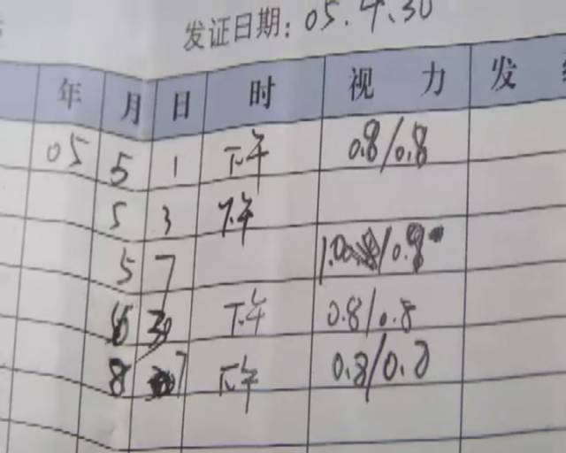 记者体验治疗近视,治疗近视的真实案例